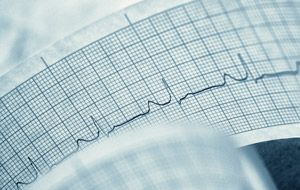 2017 stress test FAQ